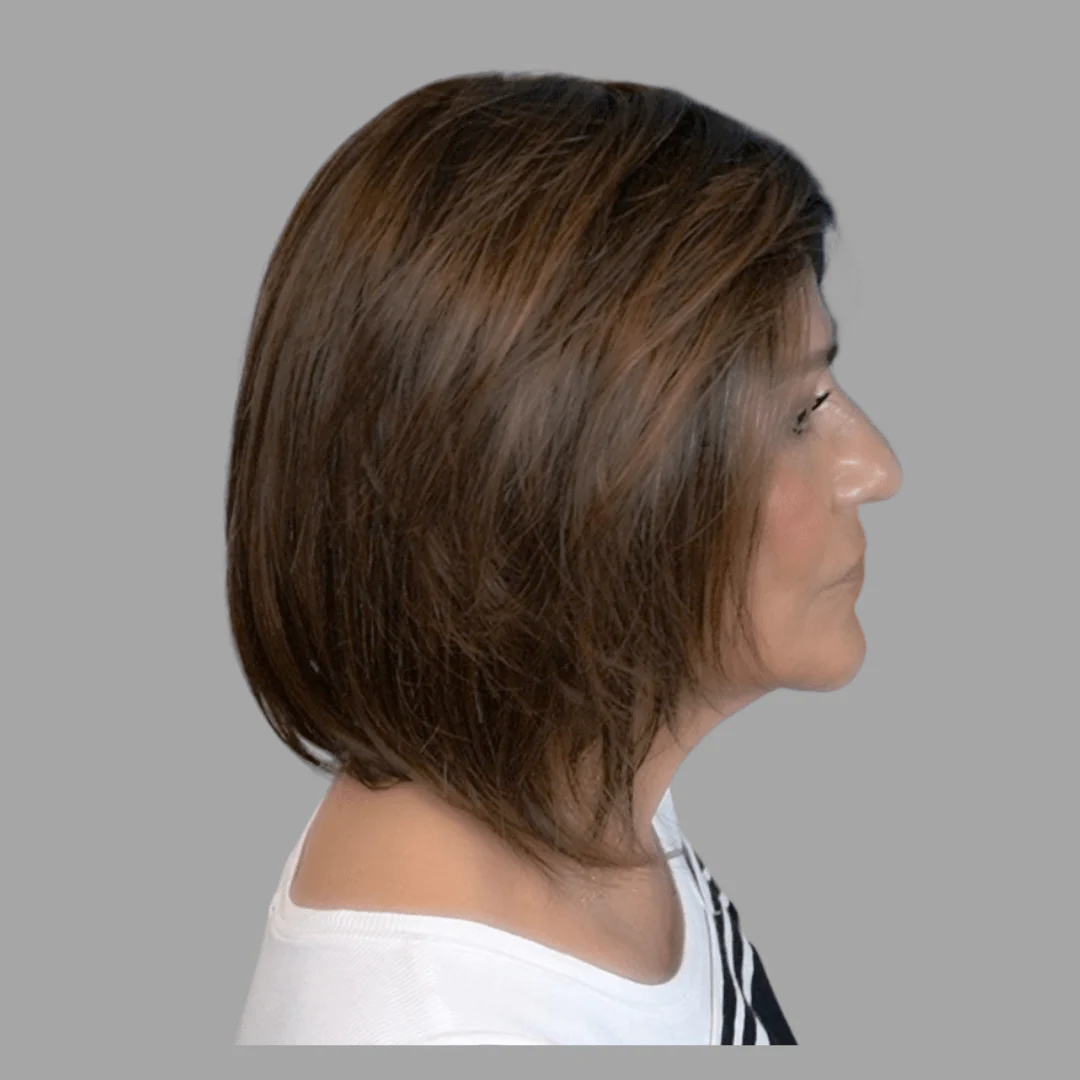 Sybil by Amore | Synthetic Lace Front Wig | Double Mono Top - Image 20